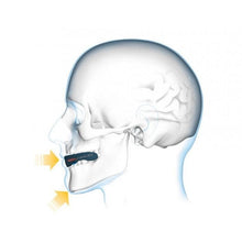 Cargar imagen en el visor de la galería, Protector Bucal Shock Doctor Gel Nano - Azul
